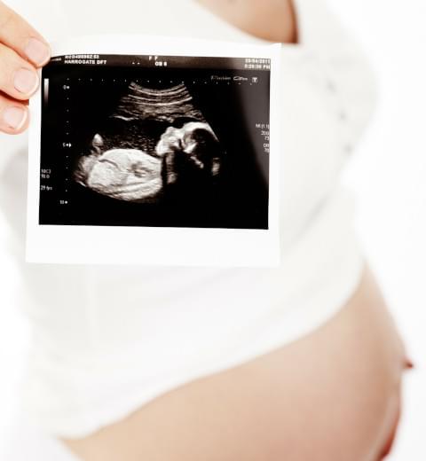 Těhotná žená ukazují obrázek z ultrazvuku